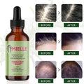 The Scalp Ritual — Complete Hair Growth Routine Kit by OLYX