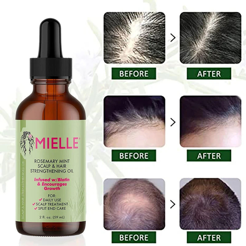 The Scalp Ritual — Complete Hair Growth Routine Kit by OLYX