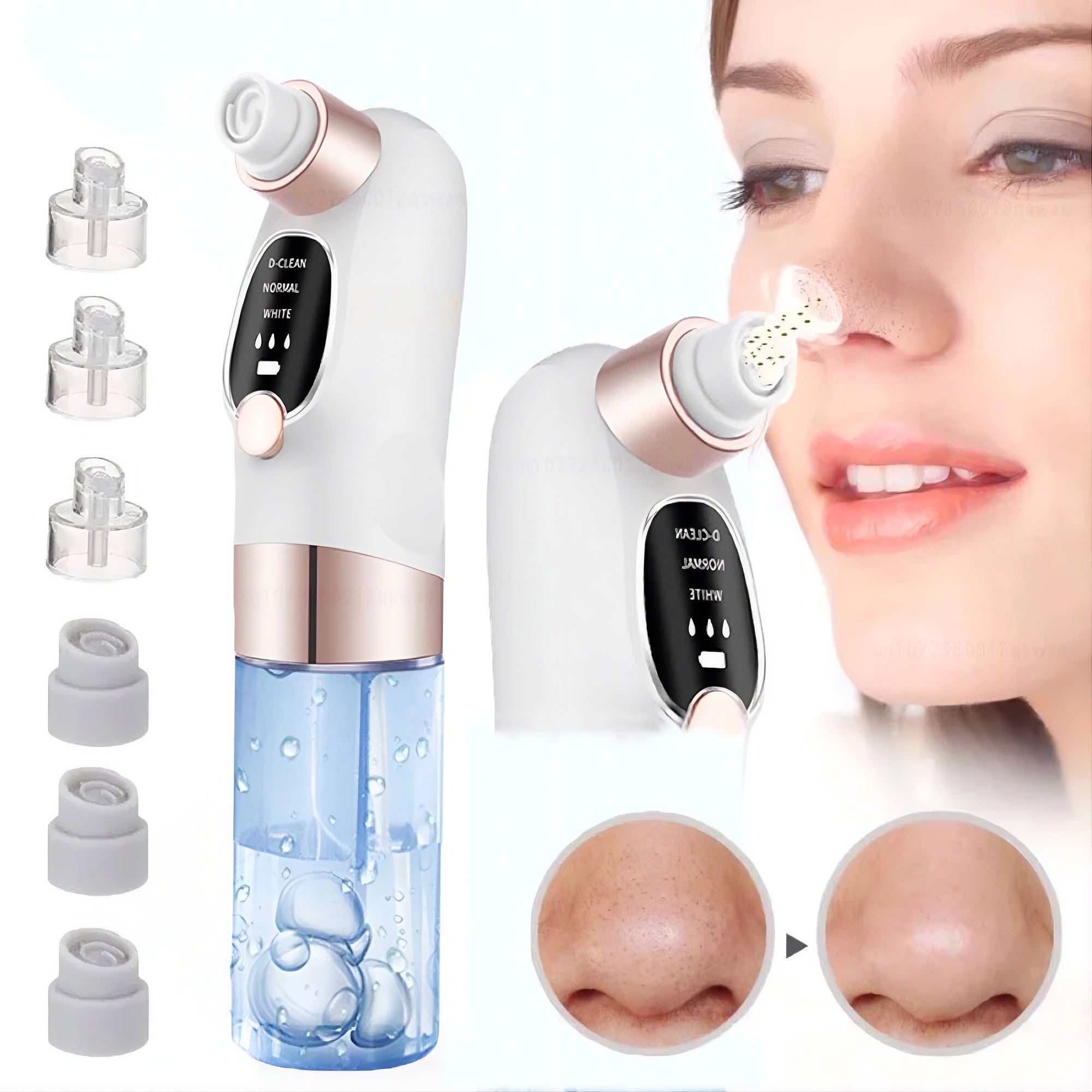 Aspirateur points noirs électrique OLYX nettoyage pores visage