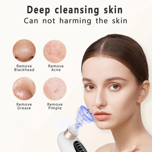 Electric Blackhead Vacuum Remover