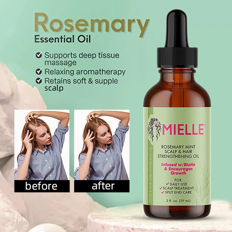 OLYX Root Revival™ — Huile de Romarin pour la Pousse des Cheveux