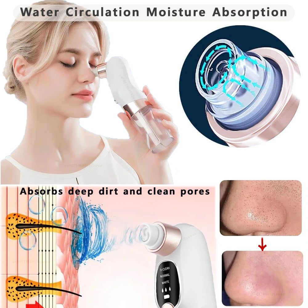 Electric Blackhead Vacuum Remover