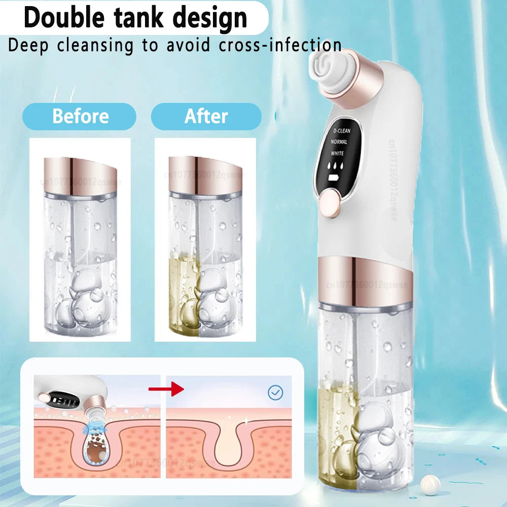 Electric Blackhead Vacuum Remover