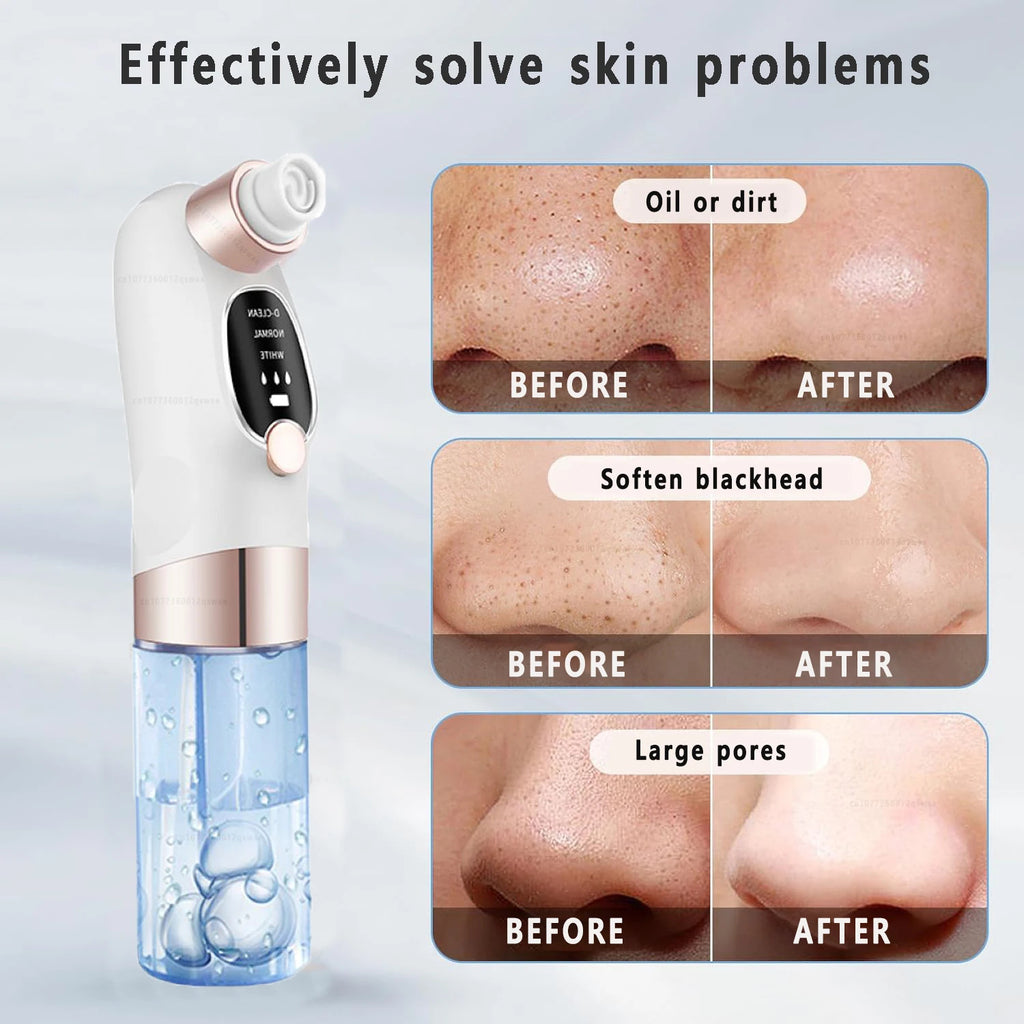 Electric Blackhead Vacuum Remover