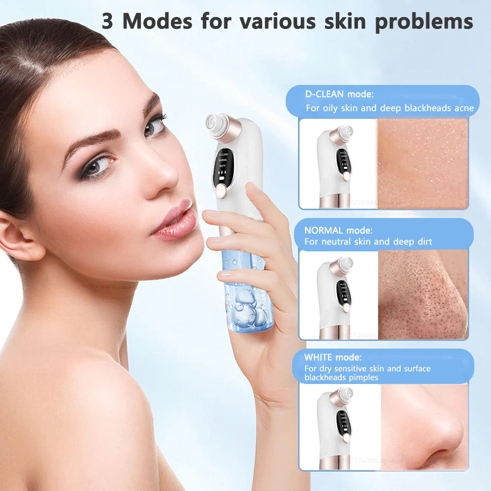 Electric Blackhead Vacuum Remover