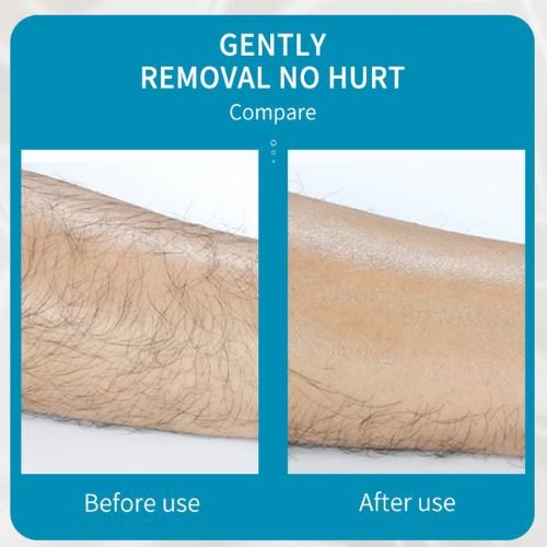OLYX Silk Glide™ — Crystal Hair Eraser & Gentle Exfoliator - OLYX-OLYX-